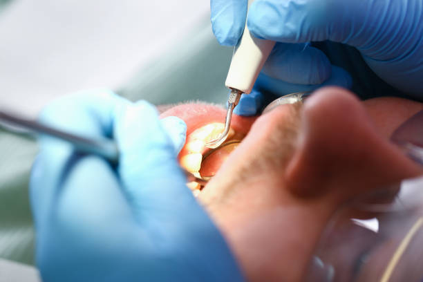 Best Emergency Treatment for Toothache in East Niles, CA