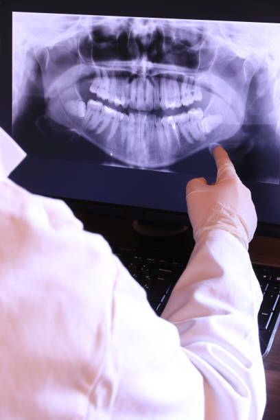 Best Pediatric Emergency Dentist in East Niles, CA
