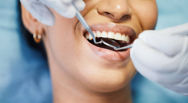 Best Pediatric Emergency Dentist in East Niles, CA